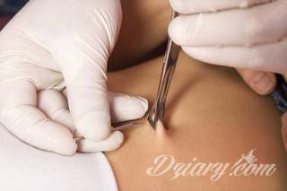 Piercing miejsc intymnych