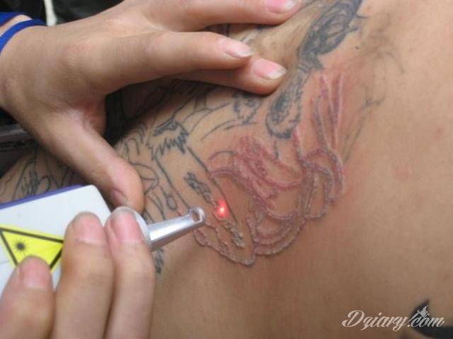 Mimo, że świadomość na temat tatuowania ciągle wzrasta, nie brakuje...