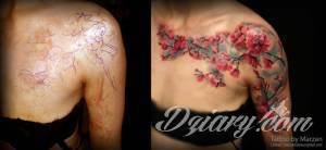 Na ratunek mogą przyjść tatuaże....