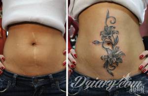 Na ratunek mogą przyjść tatuaże....