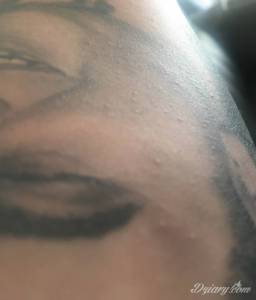 Tatuaże CZERWONE KROSTKI NA NOWYM TATUAZU Myślicie ze to uczulenie na...