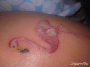  Powiedzili ze mam nie nosic...