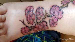 Noga dalej opuchnięta i boli...