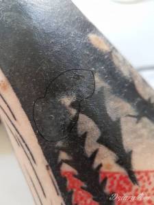 pojawiły się strupki. Opuchlizna zaczeła...