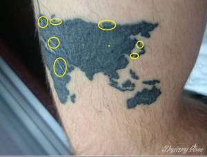 Rozumiem że już żadnych strupków...