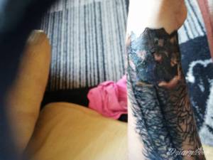 Tak wygląda to dzisiaj opuchlizna...