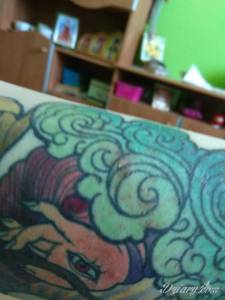 Wysypka jakby wtopiła się i...