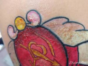 Zdjęcia nogi z dzisiaj, po...