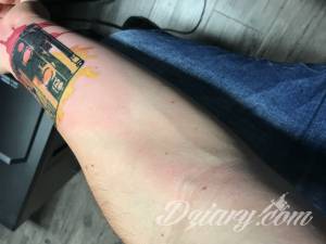 24 h po dziaraniu zrobil... Dziwny obrzęk po tatuazu