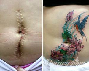 Blizny mogą przez całe życie... Ta artystka wykonuje darmowe tatuaże dla kobiet, które stały się ofiarami przemocy.