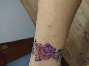 Strupy i krostki na świeżym tatuażu 