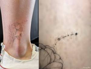 Cześć! Dwa tygodnie temu robiłam tatuaż... Rozlana linia, grubsza niż pozostałe