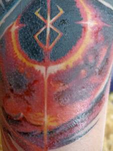 Utrzymująca się opuchlizna