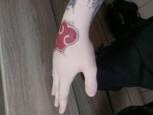 Opuchlizna i pękanie na dłoni 