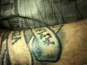 Zagojony tatuaż, problem