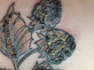 Czy powinnam się martwić?