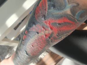 Bąble pod syarymi tatuazami