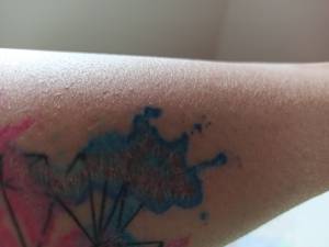 Pomocy! Chyba nie goi się dobrze... 