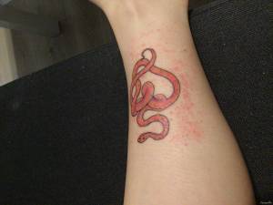 Krosty dookoła tatuażu