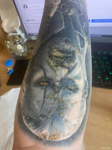 Tragicznie wyglądający tatuaż po tygodniu gojenia, ubytki i strupy