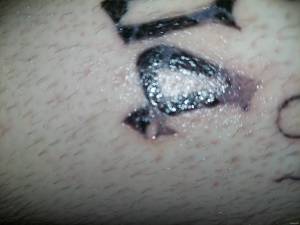 Czy tatuaż się nie przyjął 