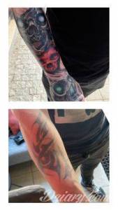 KOREKCJA I POPRAWIENIE NIEUDANEGO TATUAŻU