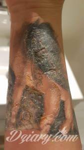 Oryginał pochodzi z grupy na... Uważaj jak i gdzie robisz tatuaż!