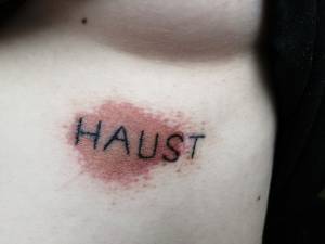 Intensywne zaczerwienienie 