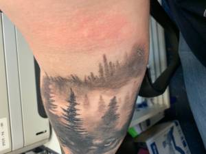 Rumień nieco powyżej tatuażu 