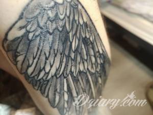 Czy to jest normalne przy gojeniu?