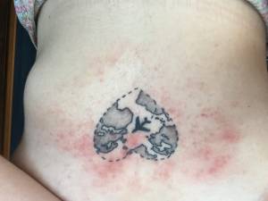 Problem z tatuażem. 