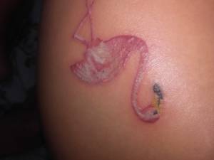 Zle zrobiony tatuaz prosze o rade