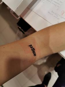 Duże zaczerwienienie po zdjęciu opatrunku