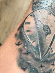 Małe krostki po tygodniu gojenia