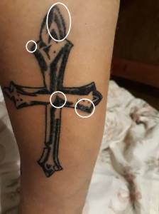 Za głęboko wbita igła czy jakieś zakażenie ? Pomóżcie :D