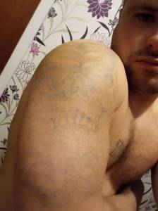 Mój tatuaż po 2 sesjach laseru. Chcę go zakryć. Czy muszę robić więcej sesji? [FOTO]