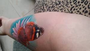 Opuchlizna goraca ręka 