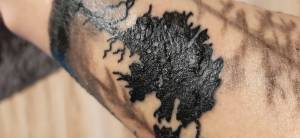 Witam. 5 dni temu wykonałem... Tatuaz przedramie