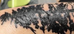 Witam. 5 dni temu wykonałem... Tatuaz przedramie