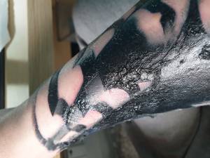 Zaoranie, infekcja , czy wszystko ok ?