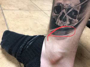 Do poprawki czy nie?