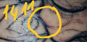 Problem czy to infekcja  ?