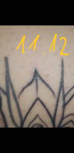 Problem czy to infekcja  ?