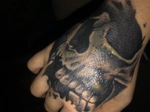 Dziwne żółte strupki