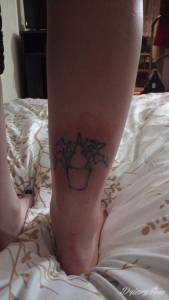 Powikłania po czasie