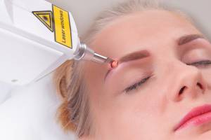 Usuwanie tatuażu laserem - współpraca dla studia tatuażu