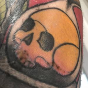 Problem z gojeniem czy opanowane?