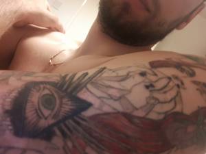 Biały tusz. Problem z gojeniem.