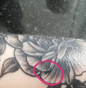 Tatuaż robiłam dwa tygodnie temu nagle pojawiło mi się na nim zwypuklenie czy ono zniknie? 