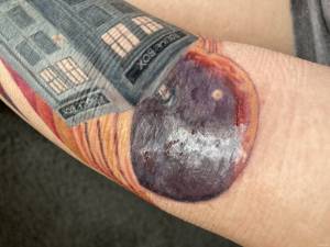 Czy to alergia, czy zakażenie?